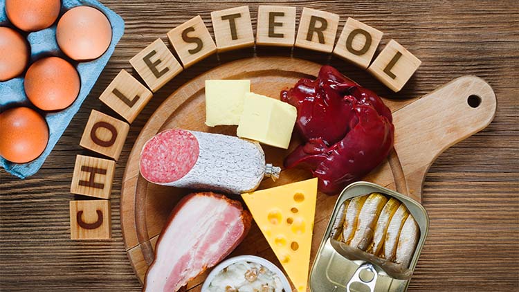 High-Cholesterol Foods